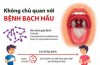 Những điều cần biết về căn bệnh bạch hầu.